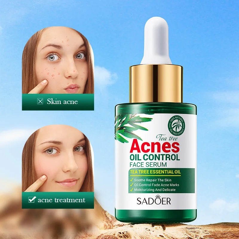 SADOER Tea  Tree Acne Oil Control Face Serum Shrink Pores Acne Treatment Moisturizing Smooth Firming Skin Beauty Skin Care